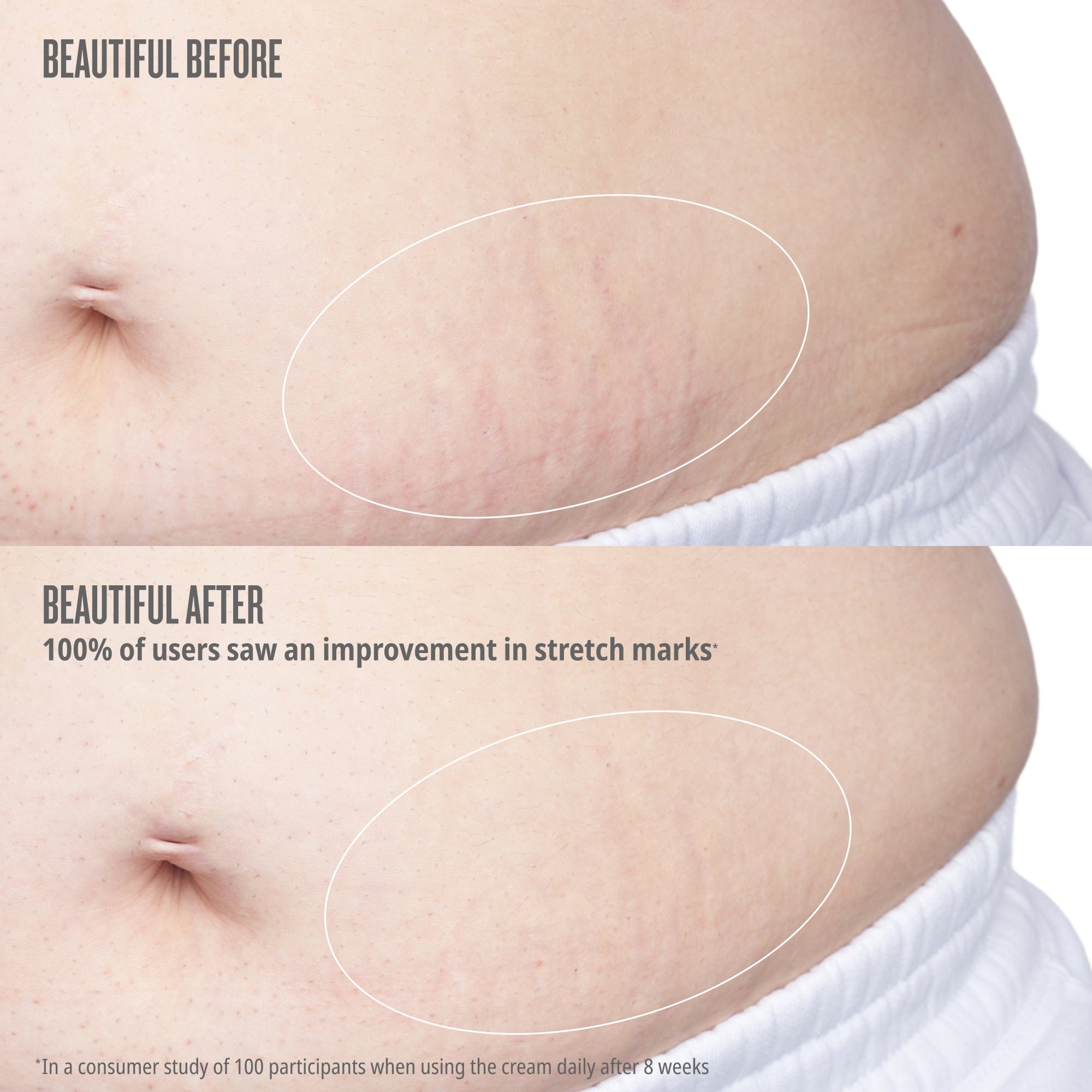 Beija Flor™ Elasti-Body Oil - Image 4