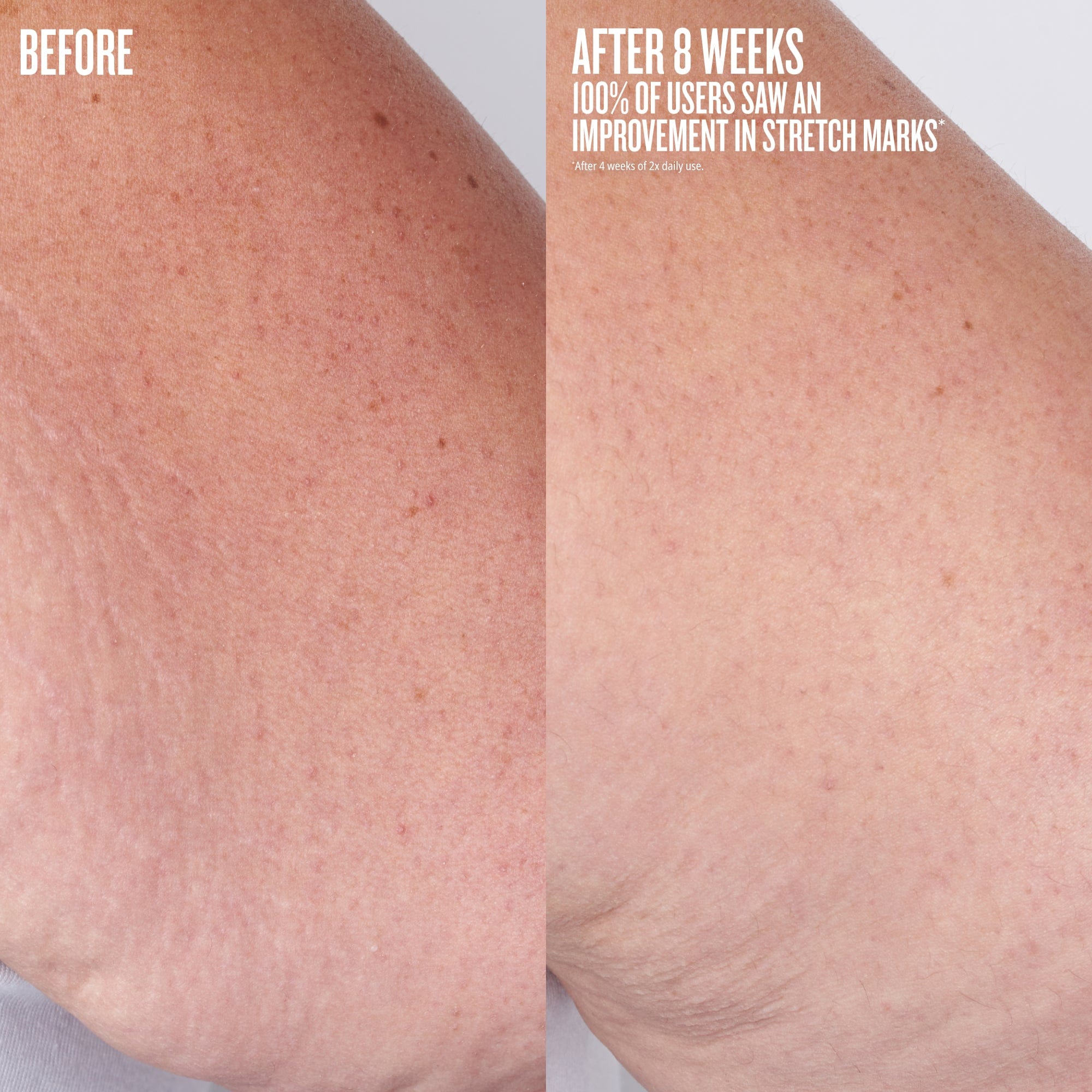 Beija Flor™ Elasti-Body Oil - Image 5